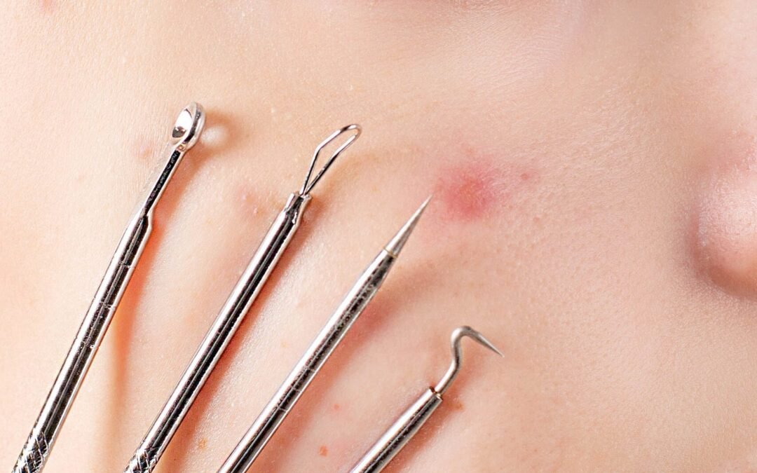 Les problèmes de peau